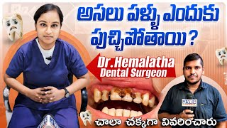 Why Get Teeth Cavity how to protect from teeth Cavity  Dental surgeon Dr Hemalatha Explanation [upl. by Mikaela597]