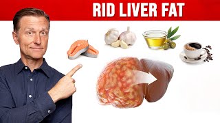 The BEST Foods for a Fatty Liver MUST WATCH [upl. by Ailehpo]