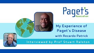 Mr Recardo Patrick explains his experience of Pagets Disease of Bone to Prof Stuart Ralston [upl. by Anitnoc]