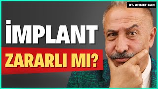 İMPLANT TEDAVİSİEn Çok Sorulan 10 Soru   Dt Ahmet Can Ertüz [upl. by Gaddi]