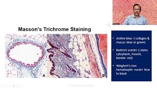 MD DNB Practical CONNECTIVE TISSUE STAINS Massons Trichrome Univ Exam [upl. by Annabelle806]