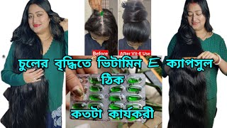 আমি কী উপায় vitamin E ক্যাপসুল ব্যবহার করে চুল লম্বা করেছি  my hairgrowth story haircare [upl. by Nagaek]