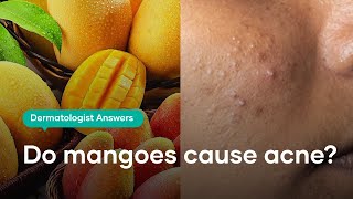 Can eating mangoes increase your pimples [upl. by Yelhs]