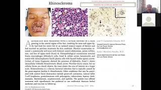 Klebsiella Enterobacter proteus and other enterobacteria [upl. by Johnny]