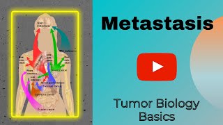 Metastasis  Cancer Biology  Genesis Academy [upl. by Mosier]