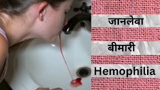 KYU SARIR KA BLOOD ACCIDENT KE BAD NHI RUKTA HAI  HEMOPHILIA KYA Hota hai  HARIOM KUMAR [upl. by Nahshu]