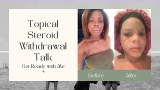 Eczema amp Topical Steroid Withdrawal Journey  My Healing Journey [upl. by Gristede]