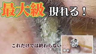 【耳掃除】30 耳かき 〜耳栓ではありません動画前半・後半に匠の技編〜 earwax [upl. by Attekram]