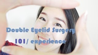 Double Eyelid Surgery experience101 [upl. by Anaicilef914]