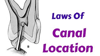 How to Find Canals in RCT  Laws Of Canal Location During ACP  Endodontic Lecture amp Tutorial [upl. by Ttiwed]