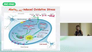 Redox Proteomics Studies to Decipher the Neurobiology of Alzheimerlike Neurodegeneration [upl. by Laney]