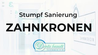 Stumpfsanierung bei Zahnkronen [upl. by Leroi35]