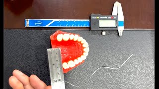 Inter molar distance or dental arch width measuring at home for patients [upl. by Yekram289]