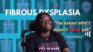 Living With Fibrous Dysplasia [upl. by Arlana]