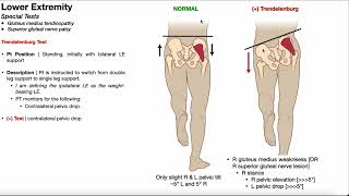 Trendelenburg Test  Rationale amp Interpretation [upl. by Esile]