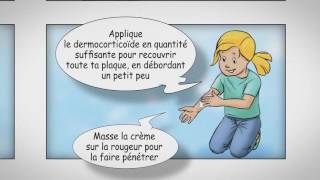 Eczéma  Comment appliquer son dermocorticoïde [upl. by Chiquia]