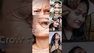 Crows feet face wrinkles yoga viralvideo antiaging shorts glowingskin wrinkles facetra skin [upl. by Pierce120]