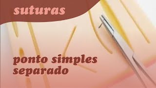 Sutura  Ponto simples separado [upl. by Pack]