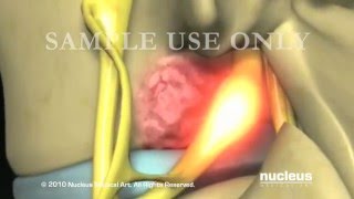 Nucleus Spine Demo Reel 2010 [upl. by Mahgem]