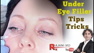 Watch Under Eye FillerTips and Tricks Portland Oregon Restylane Juvederm and PRF Injections [upl. by Daveta]