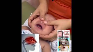 How to clear your stuffy nose in one minute parentingmethod baby [upl. by Mcgrath]