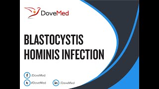 Blastocystis Hominis Infection Blastocystosis Symptoms and Causes  Diagnosis  Treatment [upl. by Bronder]