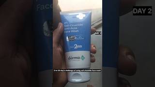 Day4 of using sali cinamide face wash  0 to 30 days challenge  shorts grooming challenge [upl. by Kelwen60]