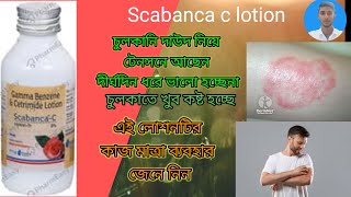 Gamma benzene cetrimideScabanca lotion চুলকানির ক্ষেত্রে ব্যবহার করা হয় scabanca lotion [upl. by Minardi]