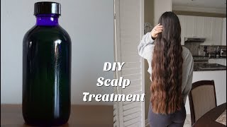 DIY Scalp Treatment for Hair Growth [upl. by Solomon]