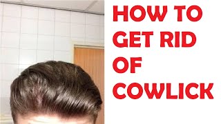 how to get rid of a cowlick on your hairline [upl. by Hpesojnhoj]