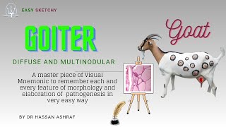 Goiter Pathology Diffuse and Multinodular  Visual Mnemonic  Endocrinology  Crack NEET PG USMLE [upl. by Nylave525]