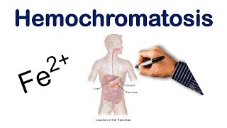 Hemochromatosis  USMLE COMLEX NCLEX [upl. by Jadda]