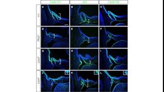 Lhx4 deficiency increases p21 expression [upl. by Vikki]