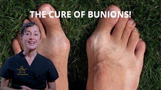 FOOT REFLEXOLOGY 🦶 to CURE BUNIONS [upl. by Airdni]