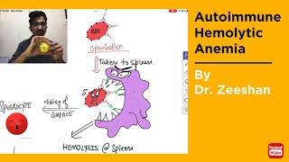 Autoimmune Hemolytic Anemia in Hindi  Hinglish ft Robbin’s pathology neetpg2022 inicet [upl. by Marrissa462]