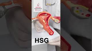 What is HSG Test When it is done  Dr Aparna  Fertility Specialist  GarbhaGudi IVF Centre [upl. by Aisiram712]