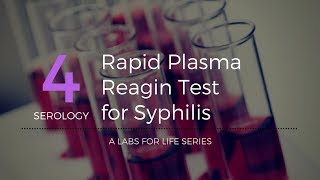 Rapid Plasma Reagin Test for Syphilis [upl. by Owen109]