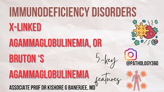 Immunodeficiency disorder  XLinked Hypogammaglobulinemia XLA or BRUTON’S Hypogammaglobulinemia [upl. by Aral744]