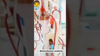 HEMODIALYSIS TREATMENTdialysis dialysishumananatomy [upl. by Enihpad]