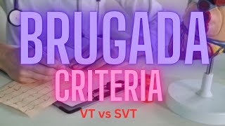 Brugada Criteria for VT vs SVT  2024 [upl. by Meibers]