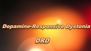 Dopamineresponsive dystonia [upl. by Marketa]