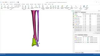 How to segment bones in MIS amp prepare them for 3D printing [upl. by Jenkins505]