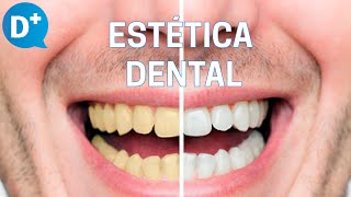 ¿Cuáles son los principales tratamientos de Estética Dental [upl. by Bamford542]