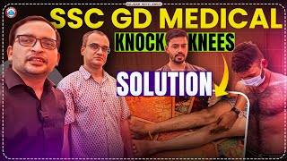 SSC GD Medical 2024 Knock Knees Solution Rojgar With Ankit rojgarwithankit rwa [upl. by Ellenwad389]