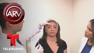 Alertan contra inyecciones para rejuvenecer el rostro  Al Rojo Vivo  Telemundo [upl. by Hilten]