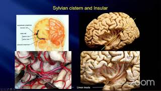 The Battlefield of Aneurysm SurgeryThe Surgical Anatomy of the Arachnoid Membranes amp CisternsInoue [upl. by Lovich]