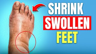 The SECRET to Reducing Swollen Feet and Ankles in No Time [upl. by Dinah122]