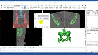 How to Use the Split Mask Tool in Mimics  Mimics Innovation Suite  Materialise Medical [upl. by Cannell589]