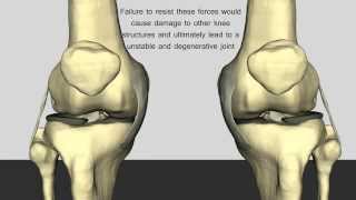 The Normal Function of the Anterior Cruciate Ligament [upl. by Oran]