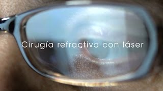 Cirugía refractiva con láser  Lasik [upl. by Sirrep]